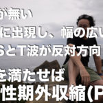 PVC（心室性期外収縮）のスコトーマ