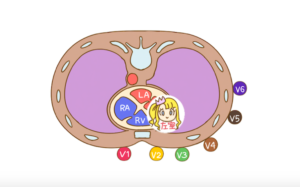 12誘導心電図と左心室壁との関係 12誘導心電図と左心室壁との関係