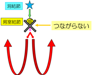 伝わらない刺激